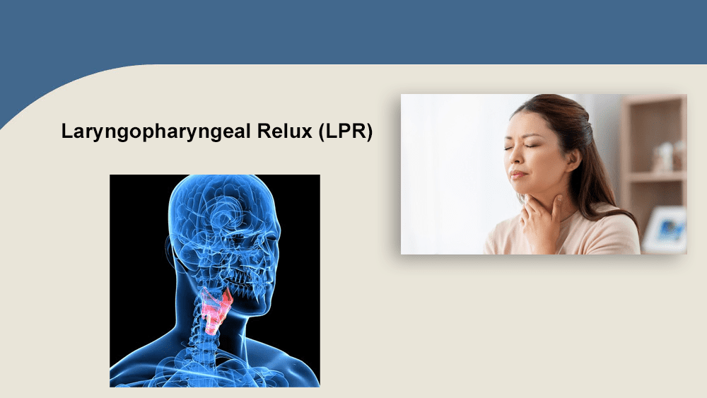 Laryngopharyngeal reflux (LPR) image